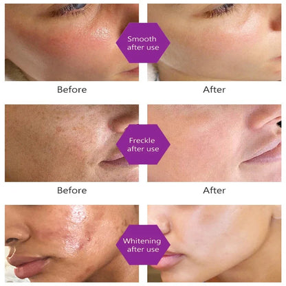 Korean Dark Spot Remover Serum – Brighten, Correct Melanin & Fade Pigmentation