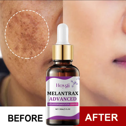 Korean Dark Spot Remover Serum – Brighten, Correct Melanin & Fade Pigmentation