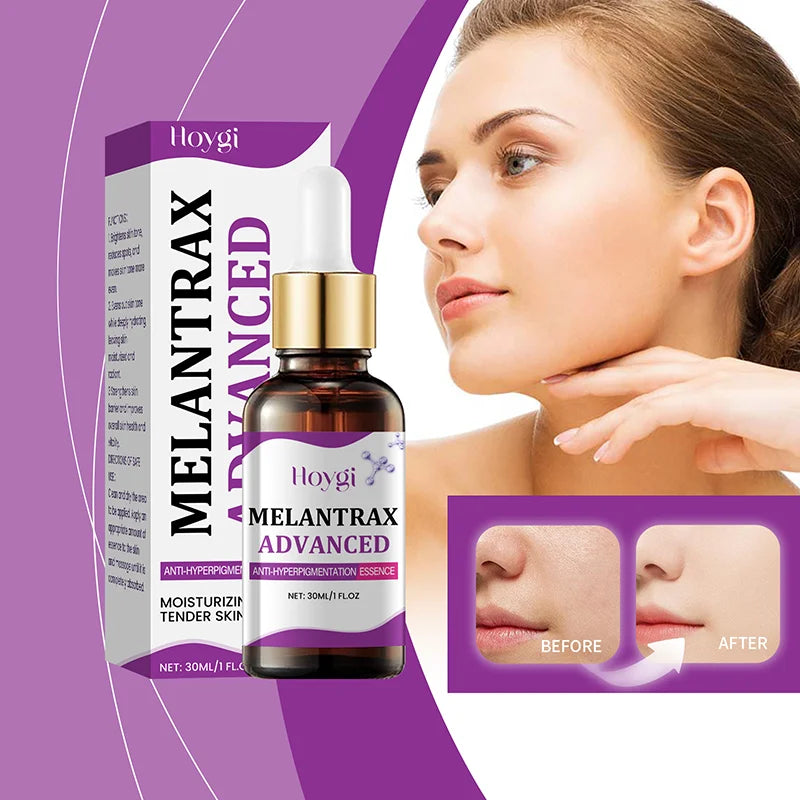 Korean Dark Spot Remover Serum – Brighten, Correct Melanin & Fade Pigmentation