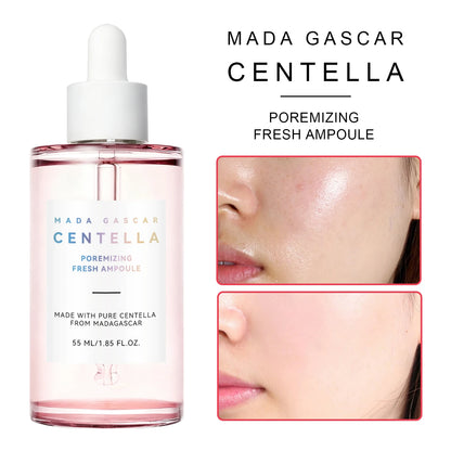 Madagascar Gotu Kola Essence 55ml | Calming Hydrating Serum