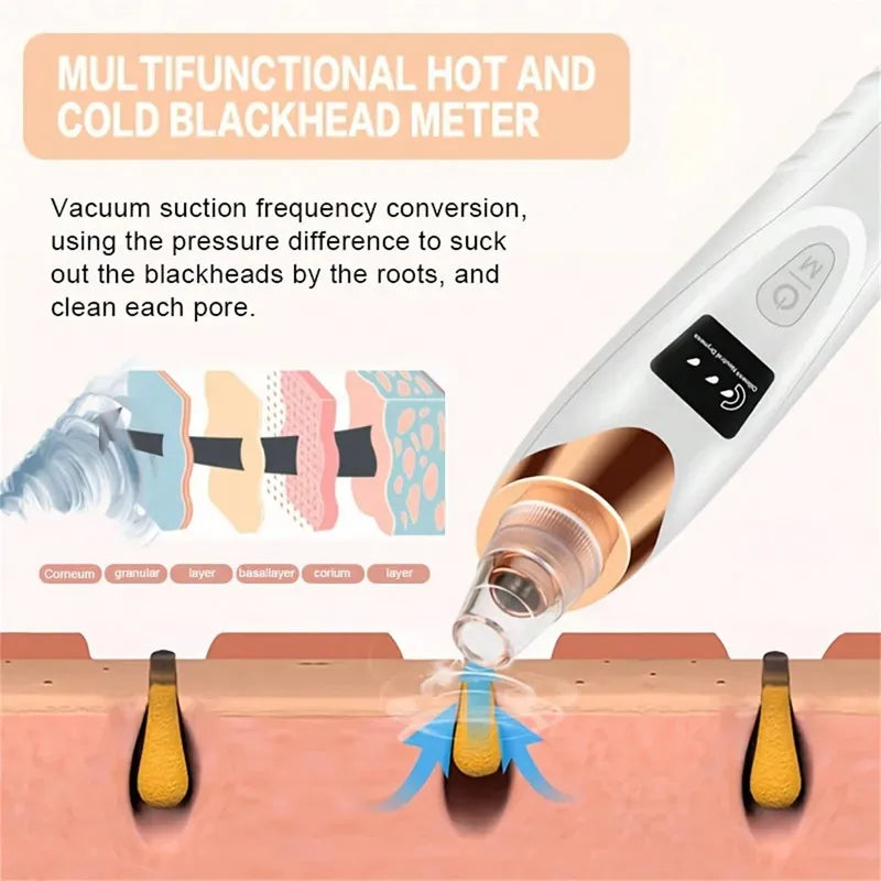 Blackhead Remover Vacuum – Deep Pore Facial Cleanser