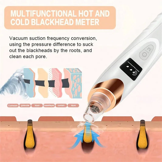 Blackhead Remover Vacuum – Deep Pore Facial Cleanser