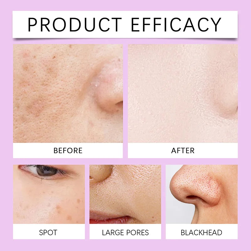 Korean Dark Spot Remover Serum – Brighten, Correct Melanin & Fade Pigmentation